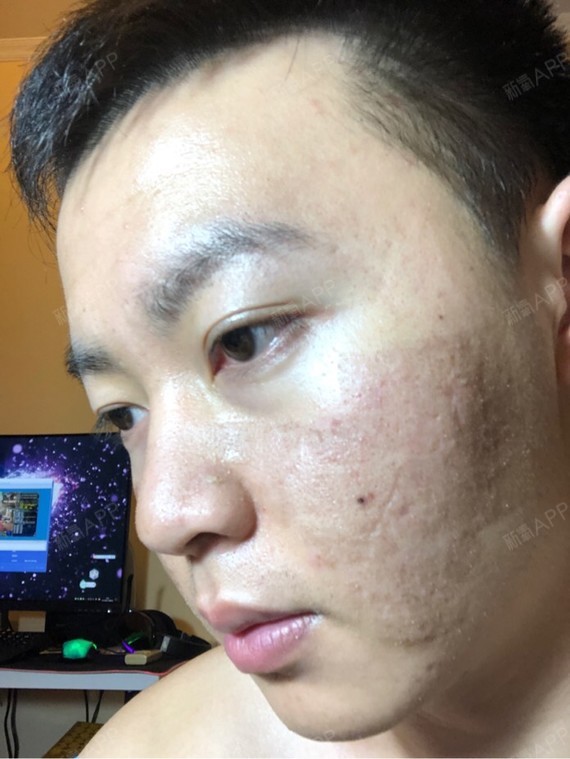 刀疤在哪抓探索未知的刀疤刷新点