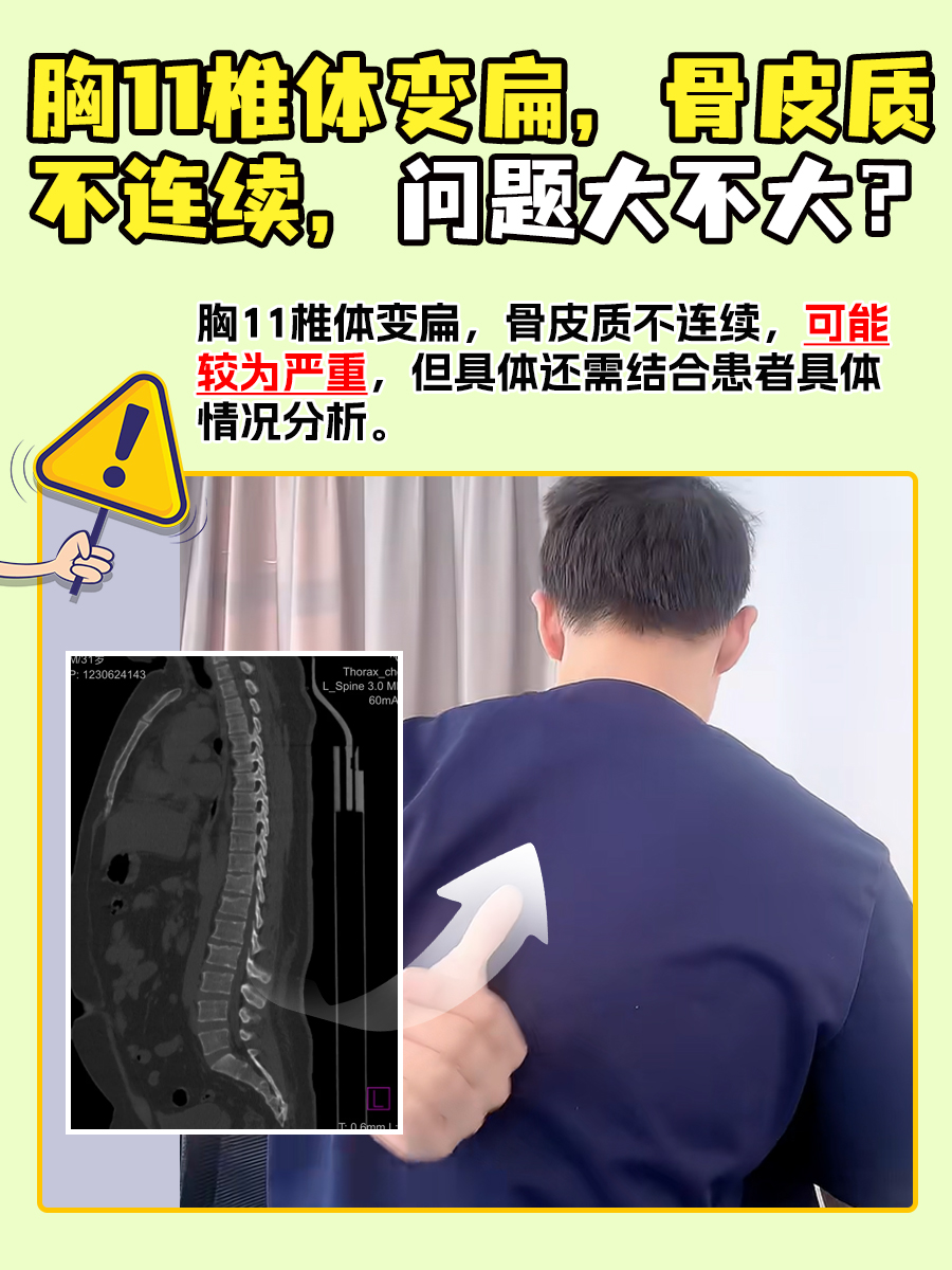 如何自罚必须非常疼又无声(怎样让胸变大变软)综合百科自罚方法须知，如何实施无声且疼痛的自我惩罚-第2张图片