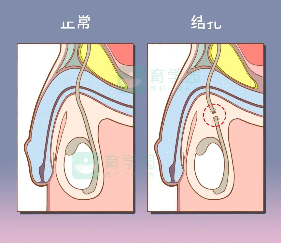 和妈妈一起学习如何避孕