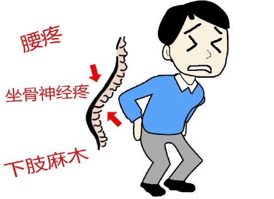 腰一沉冲破了那层障碍退出去疼突破障碍后的疼痛与恢复-第3张图片