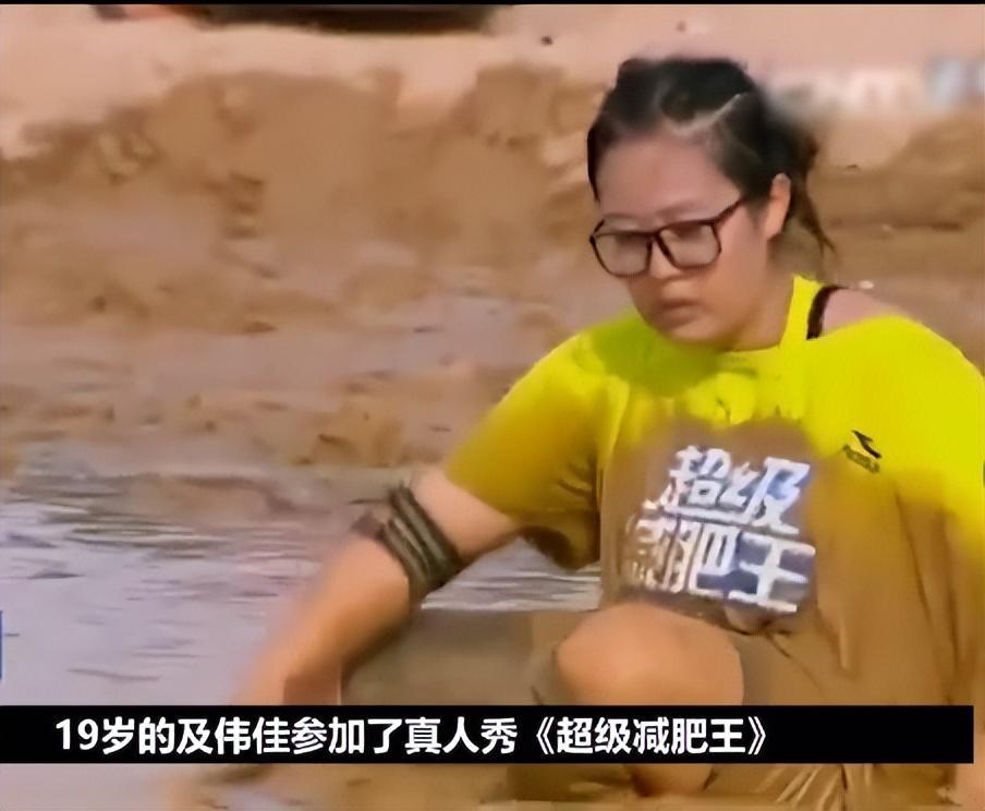 关于肥胖女性下身毛发的观察与探讨-第3张图片