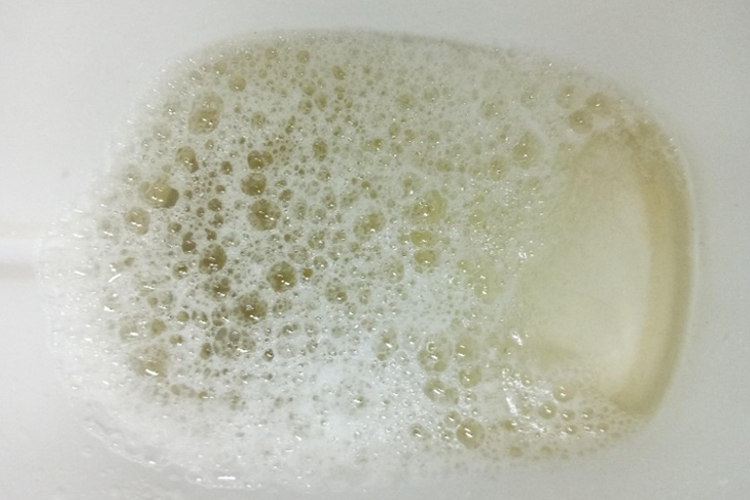 如何自己弄出白色液体如何自己制作白色液体-第2张图片