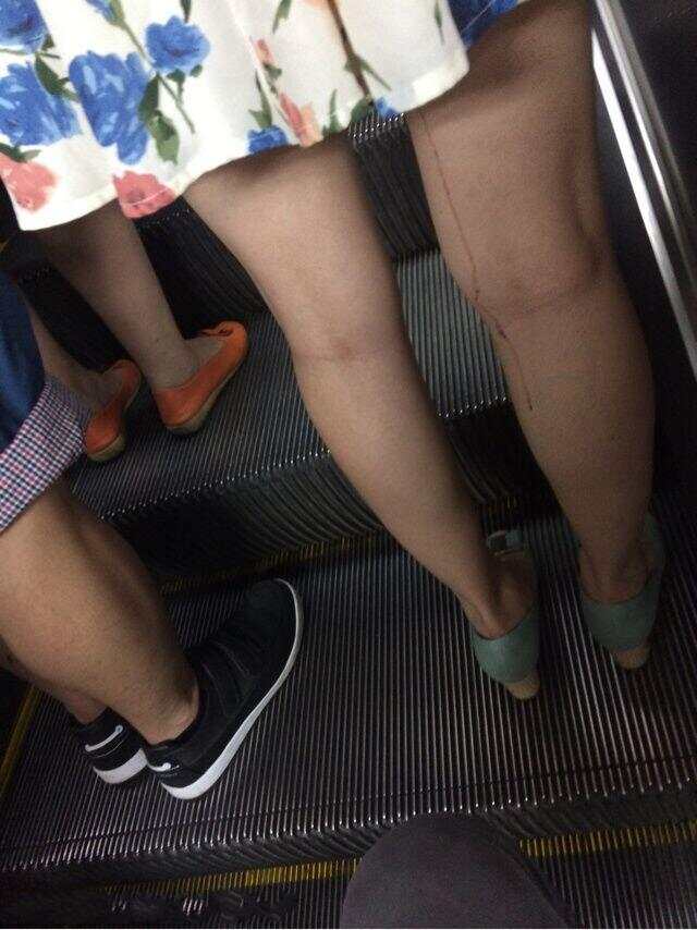 男人把困困放到女人困困里视频男人JJ的生理结构与健康-第2张图片