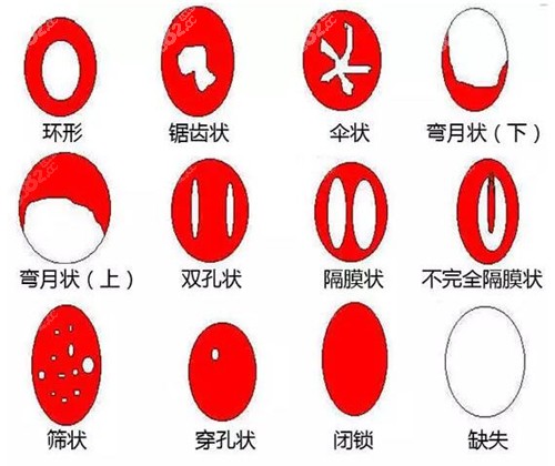 中国处女率是多少?中国网络信息与健康，关于中国女性健康问题的探讨
