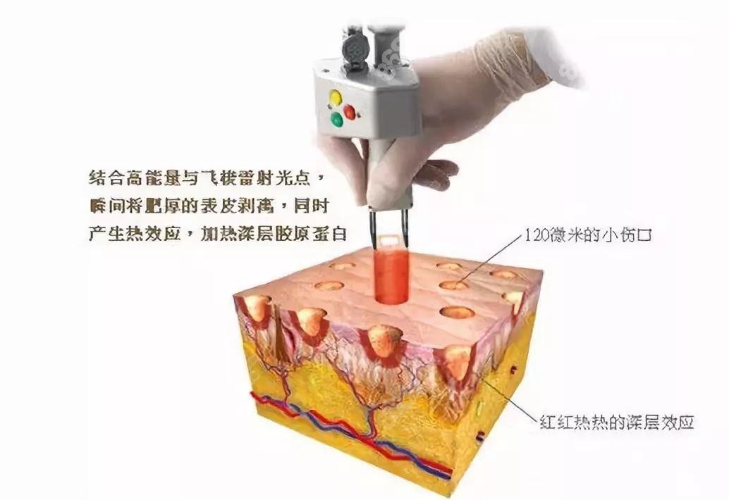 草久热现象的深度解析
