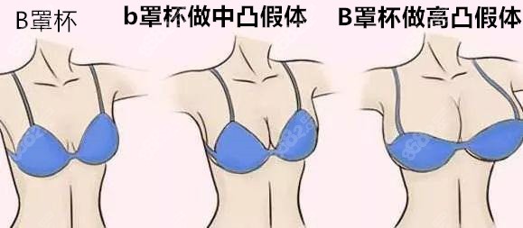 B与B不同区别深入解析B与B不同，差异与区别-第3张图片