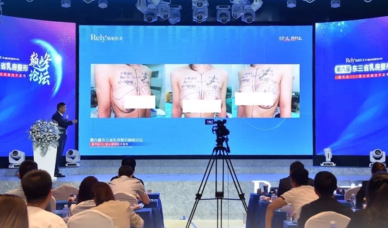 美女露胸无遮挡无马赛克羞羞关于美，我们应如何正确欣赏——无遮挡与马赛克之间的美学探讨-第2张图片