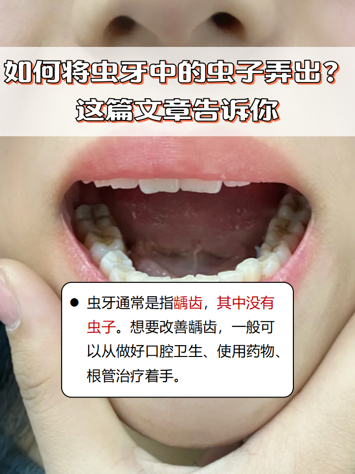 虫牙是真有虫子吗虫牙真的是牙齿有虫吗？——揭秘蚂蚁庄园的口腔健康知识
