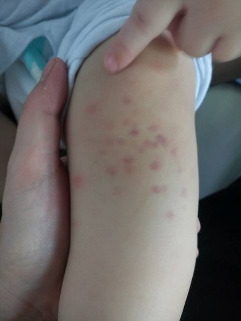 宝宝腿开大点就不疼了免费视频宝宝腿开大点就不疼了？——警惕网络健康谣言的危害-第2张图片