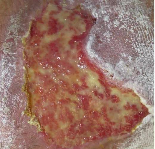 腐肉车车超多的双男主小说腐肉车，城市中的隐秘之谜