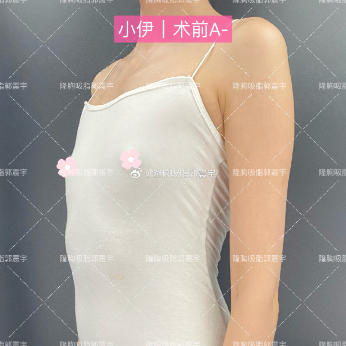 标清下的丰胸与哺乳之路