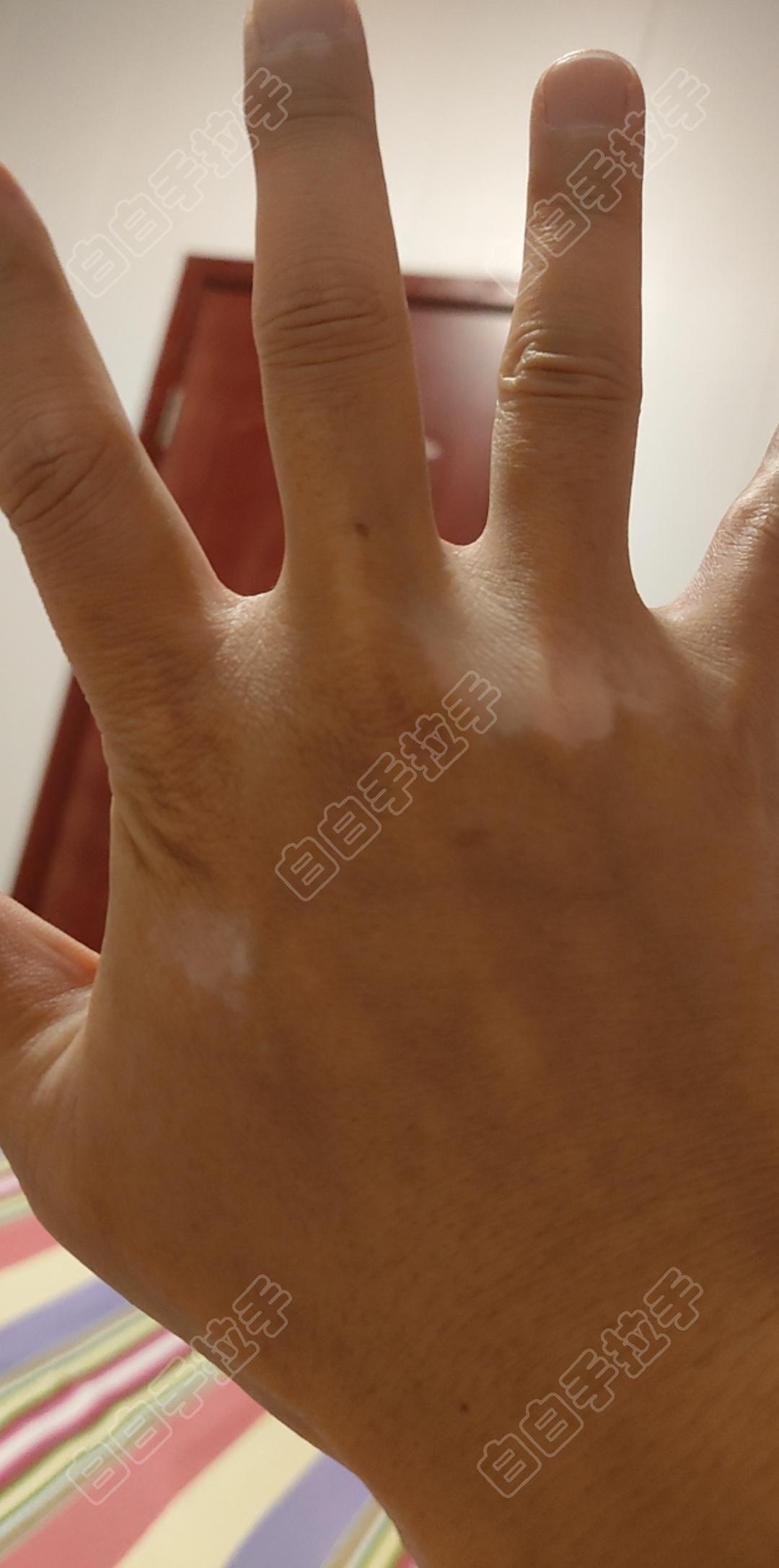 白白嫩嫩的手怎么形容白白嫩嫩的魅力——BBWBBWDIDLO的独特之处