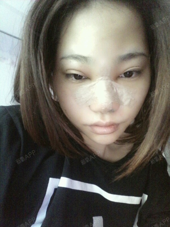 一天接了八个客人后，我的身体出现了肿胀