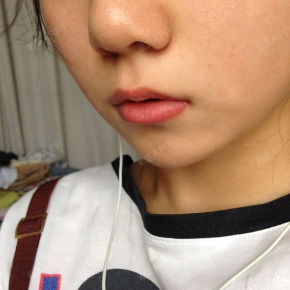 唇毛成长记，从16岁到18岁，是否还会继续生长？