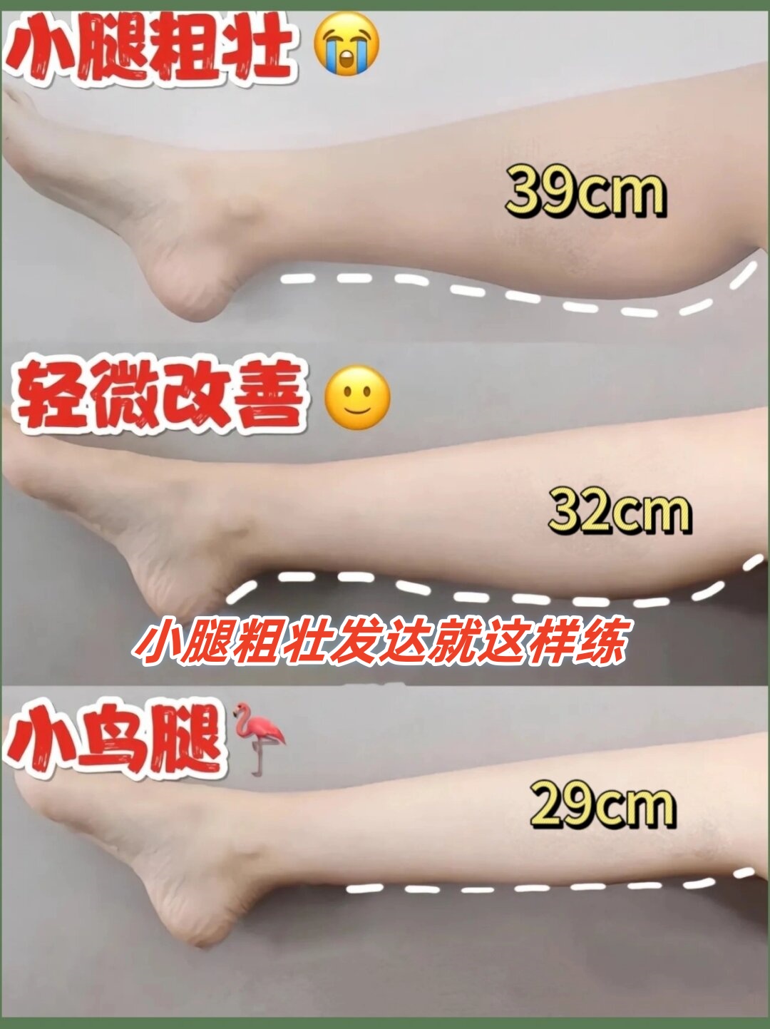 迈开腿，展现你的自信与美丽