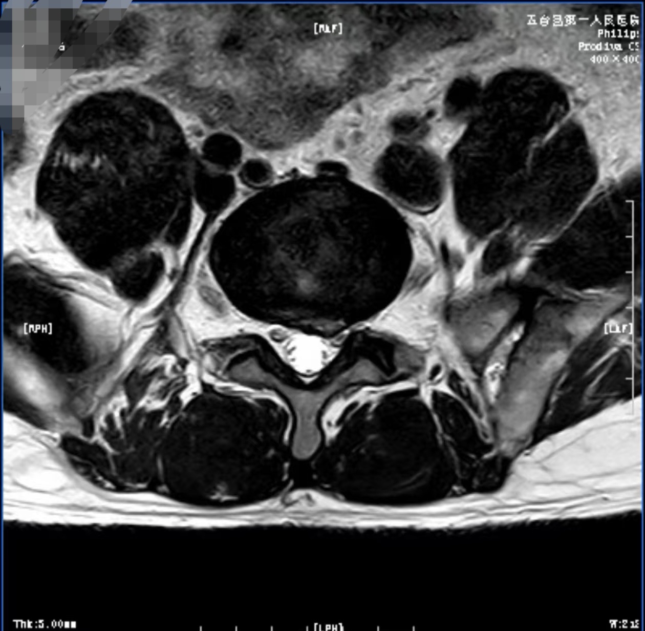 腰部猛然下沉律动腿抬高放墙上后出现麻木感，原因与应对策略-第1张图片