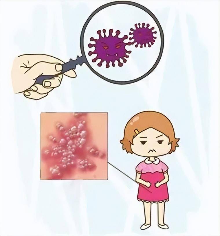 含着不拔出，HIV的误解与真相-第2张图片