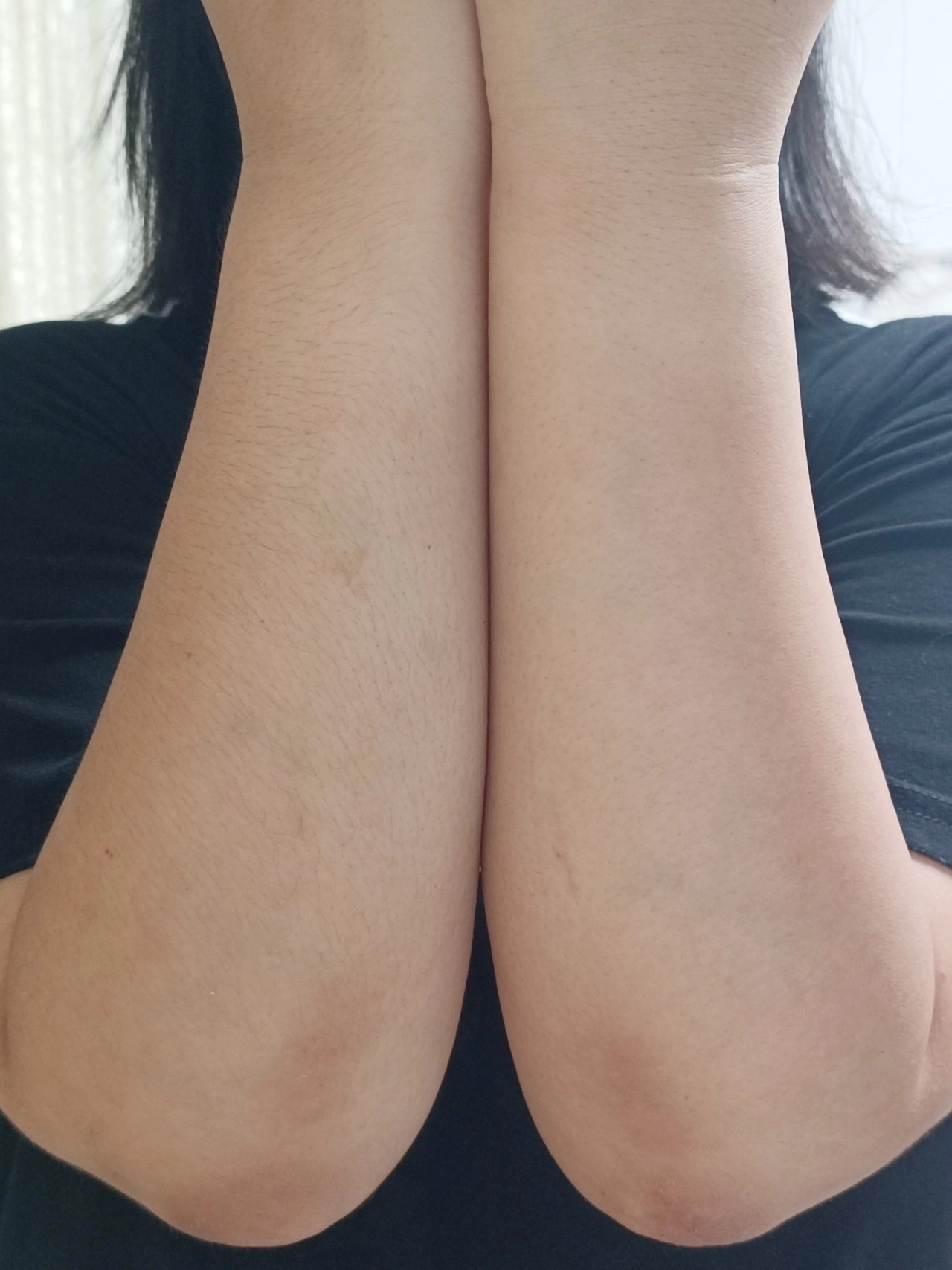 关于女性生理特征及毛发分布的探讨