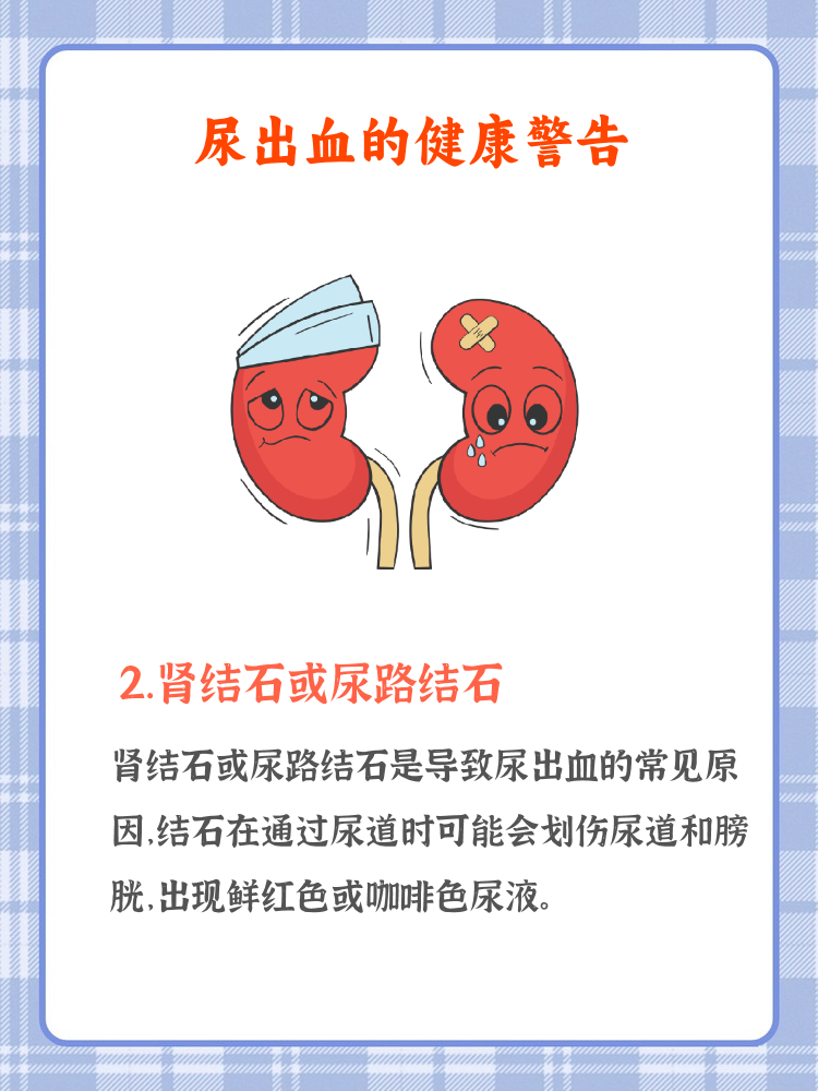 主人尿在肚子里不能流出来主人，腹中尿流之困境-第2张图片