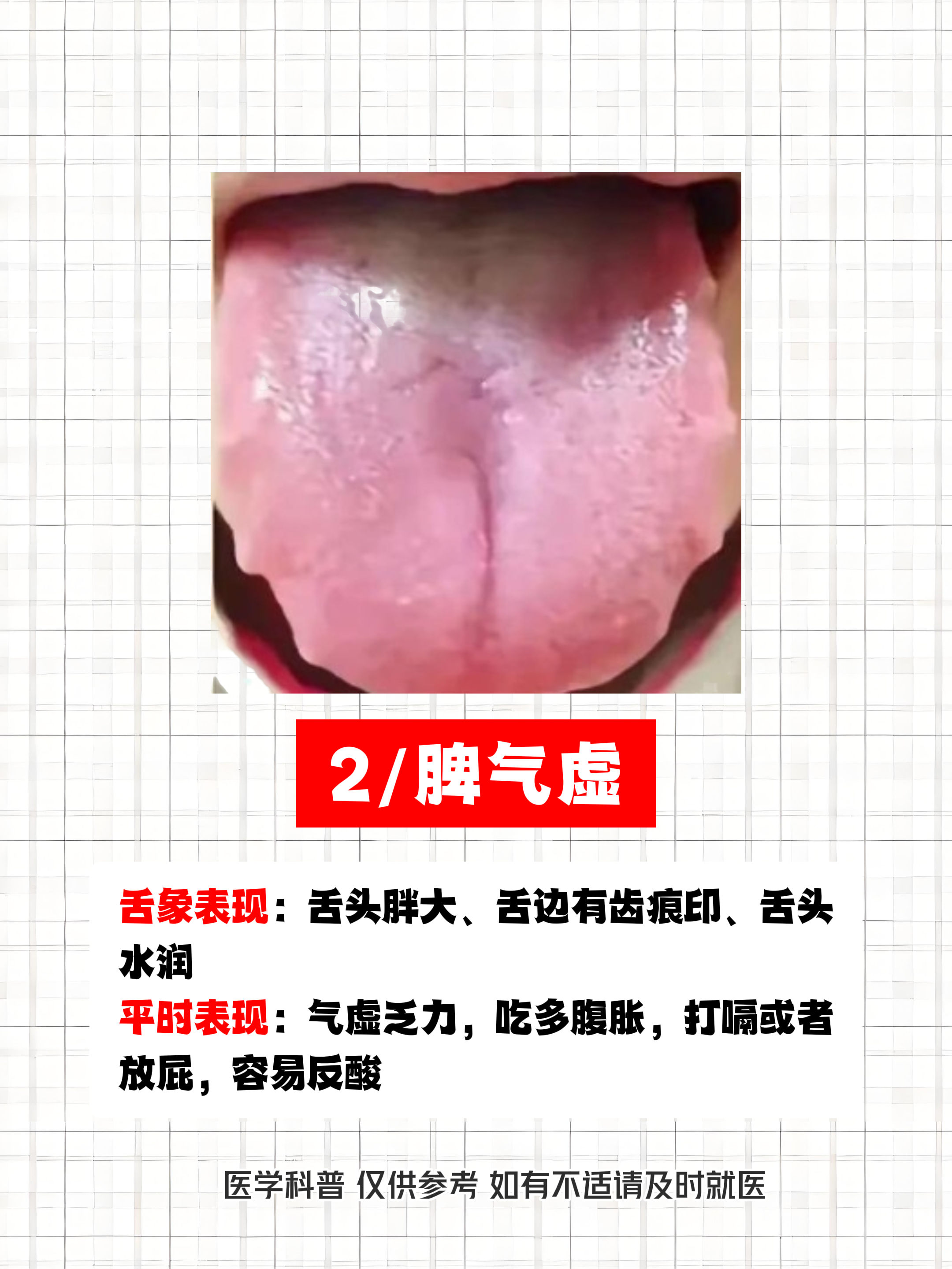 把舌头放屁眼里是感觉不舒服吗舌尖上的独特体验，把舌头放屁眼里是何感觉-第2张图片