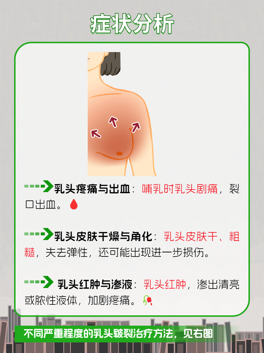 乳头被吸的疼是怎么回事厨房中的意外事件