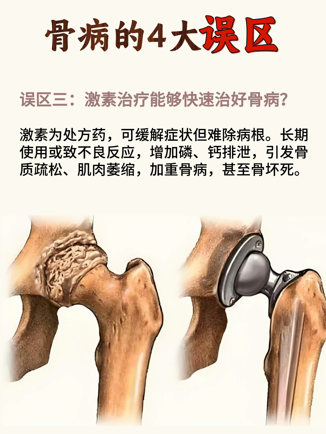 一夜六次疼到让你下不了床一夜六次疼痛经历，无法下床的深刻体验