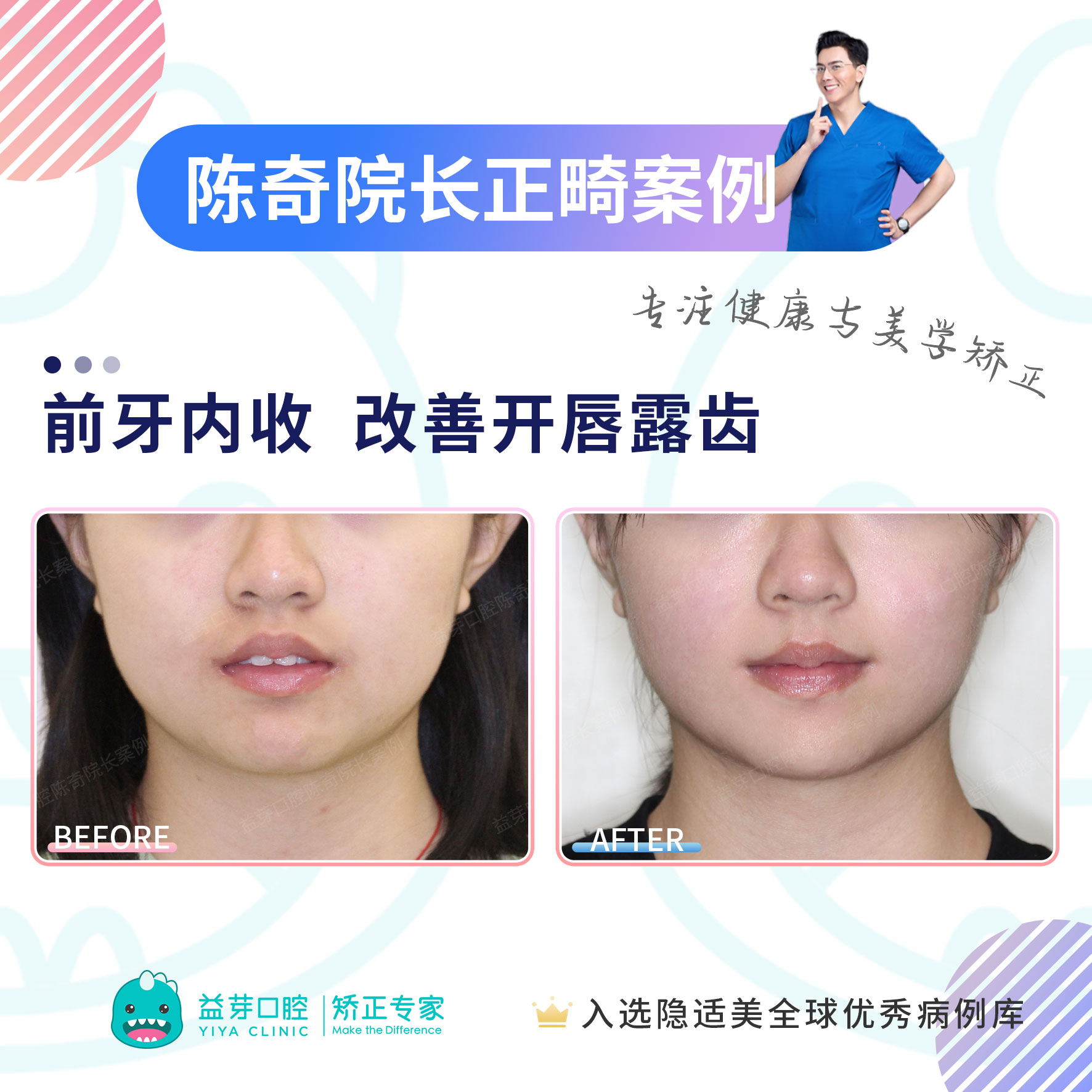 水乳交融和唇齿相依的区别深入解析水乳交融与唇齿相依的微妙区别-第3张图片