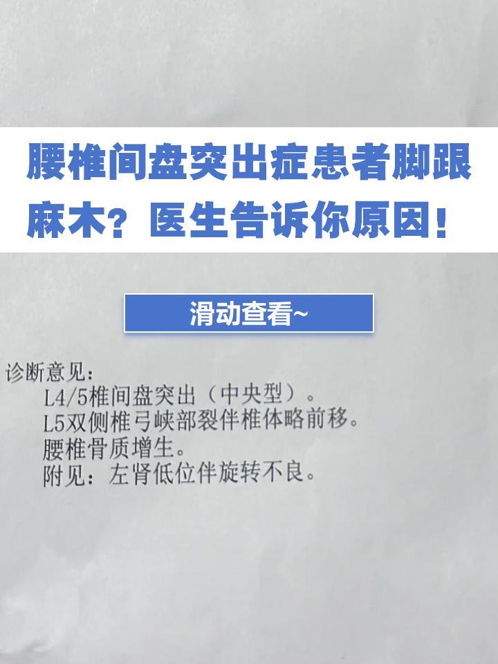 成人网站刚做完人流腰疼可以吃止痛药吗关于cheng人网站的探讨