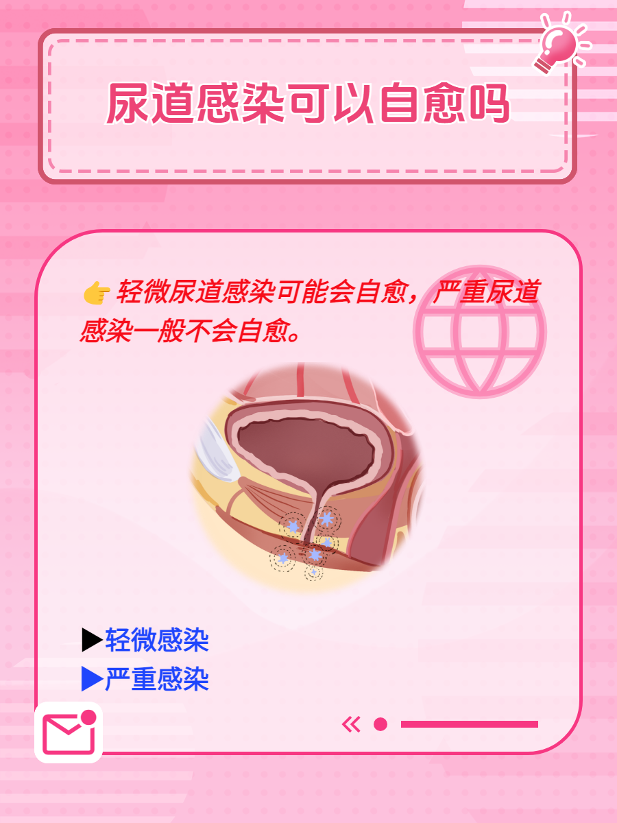 让男人玩尿道的女人探索性爱新领域，让男人玩尿道的女人是如何做到的？