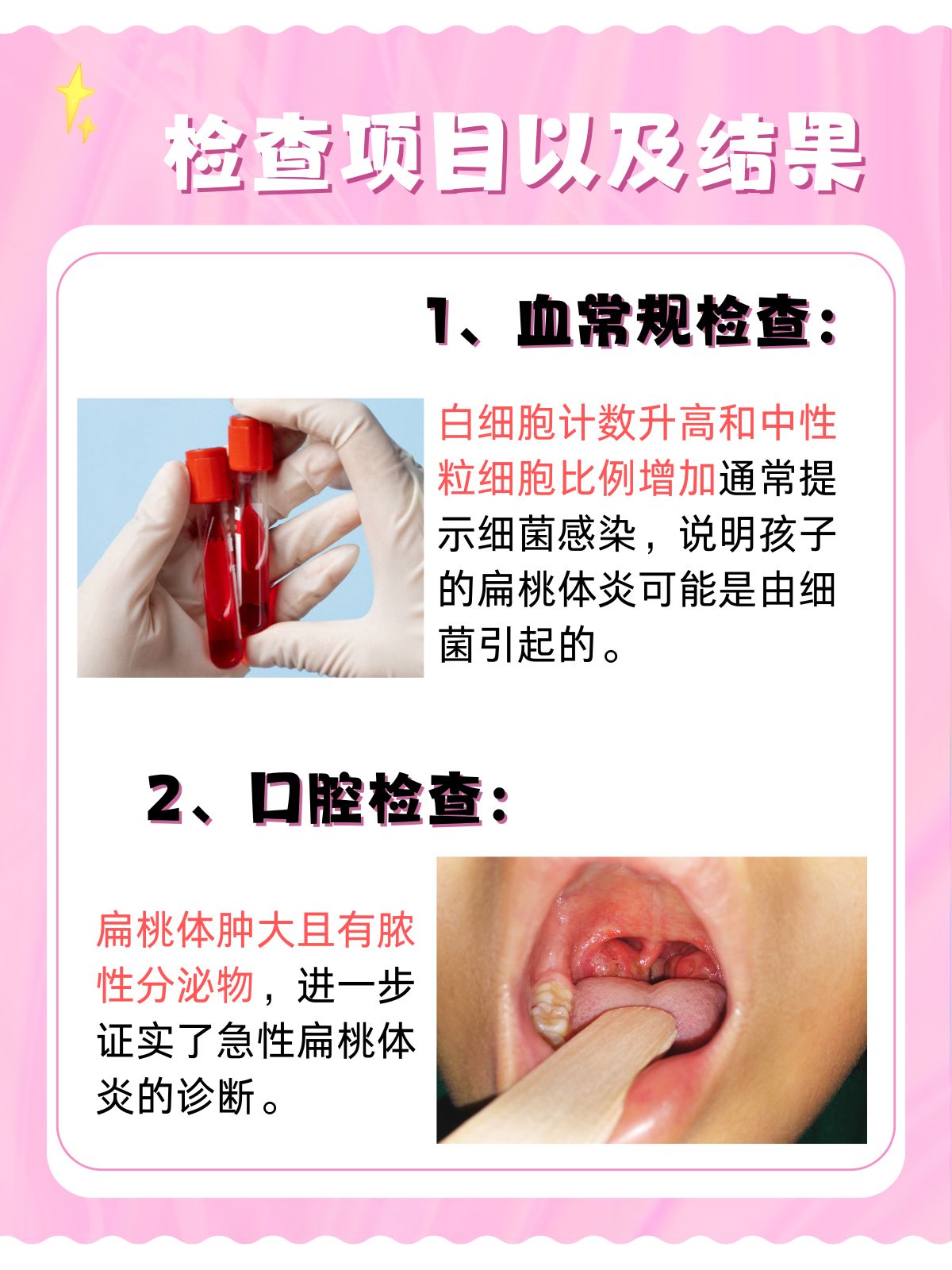如何实现整根吞到喉咙的技巧与注意事项-第3张图片