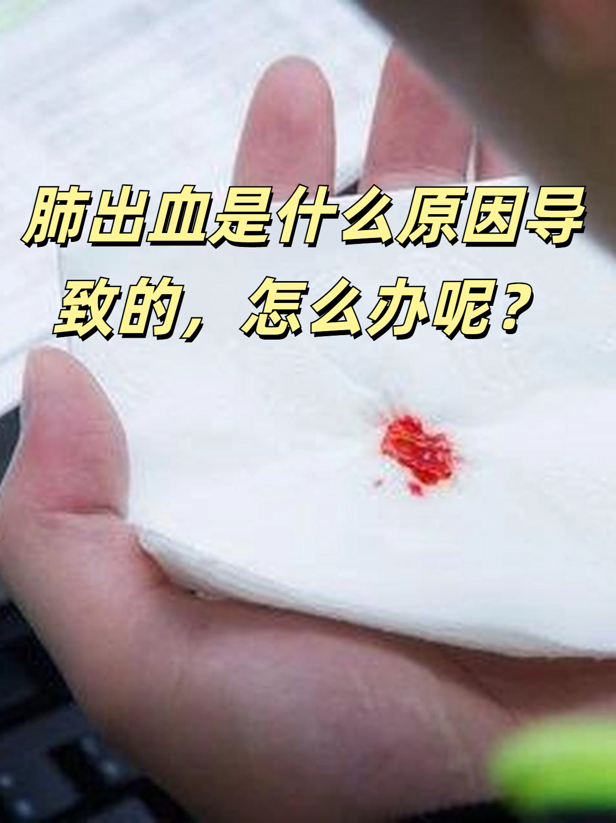 欧美videos中首次出现出血现象的探讨