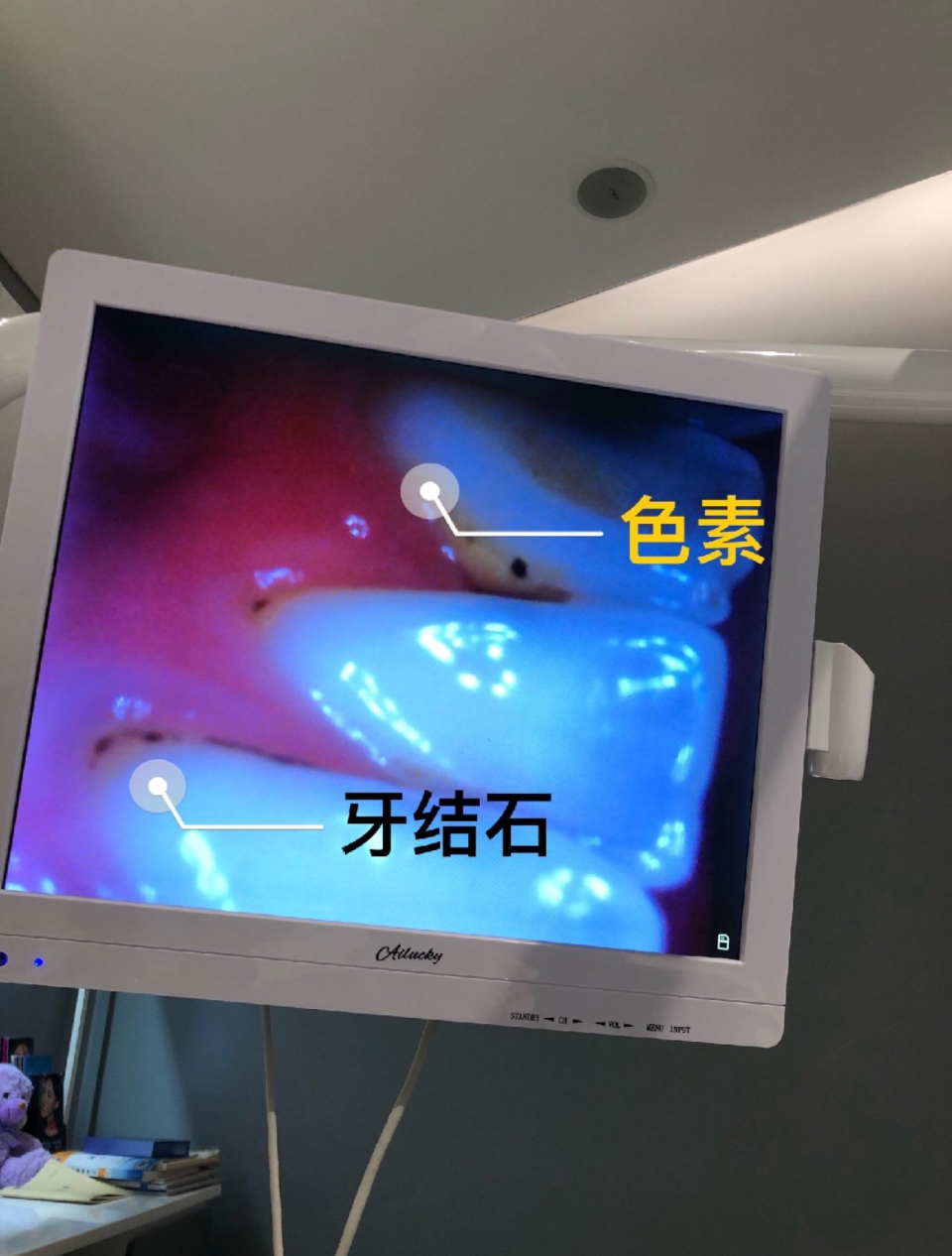 爽的含义解析