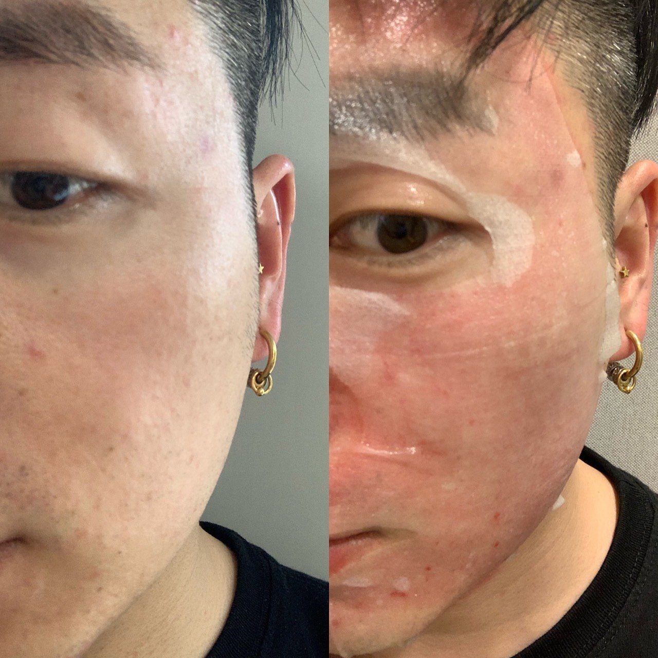 樱桃视频下载安装app与肌肤色斑的解决之道-第3张图片