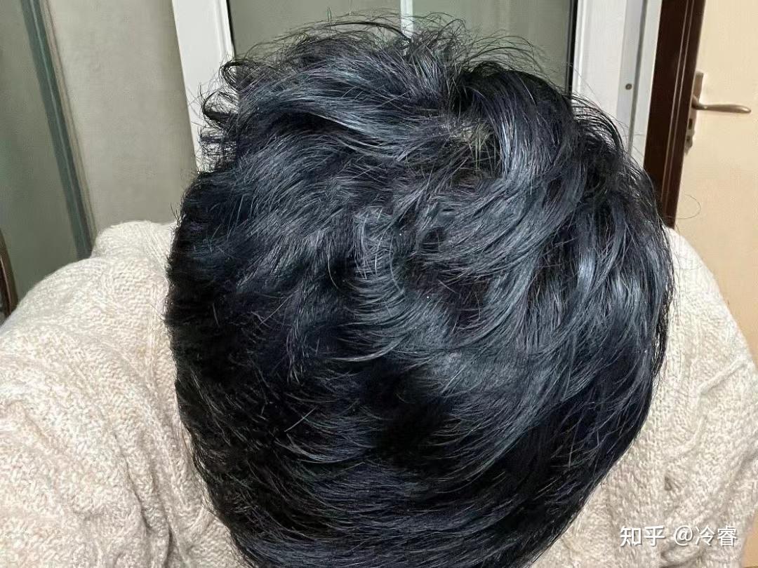 怎么知道头顶是不是秃了如何判断是否已达到极限——顶到头了？