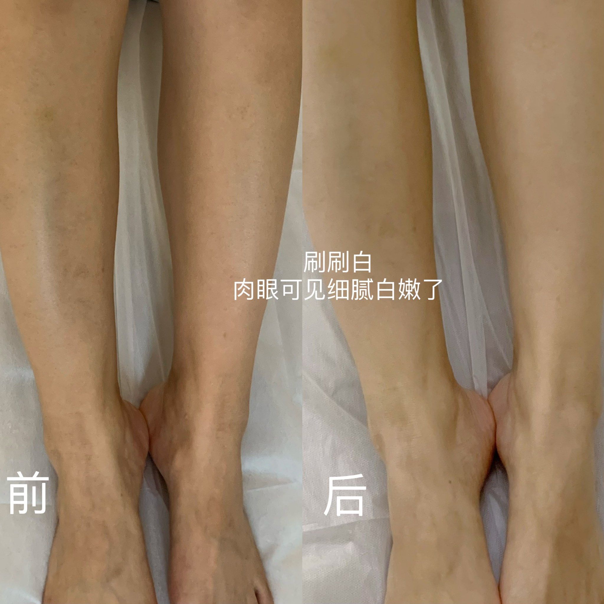 白嫩的白嫩的BBBBBB白嫩的肌肤之美-第3张图片