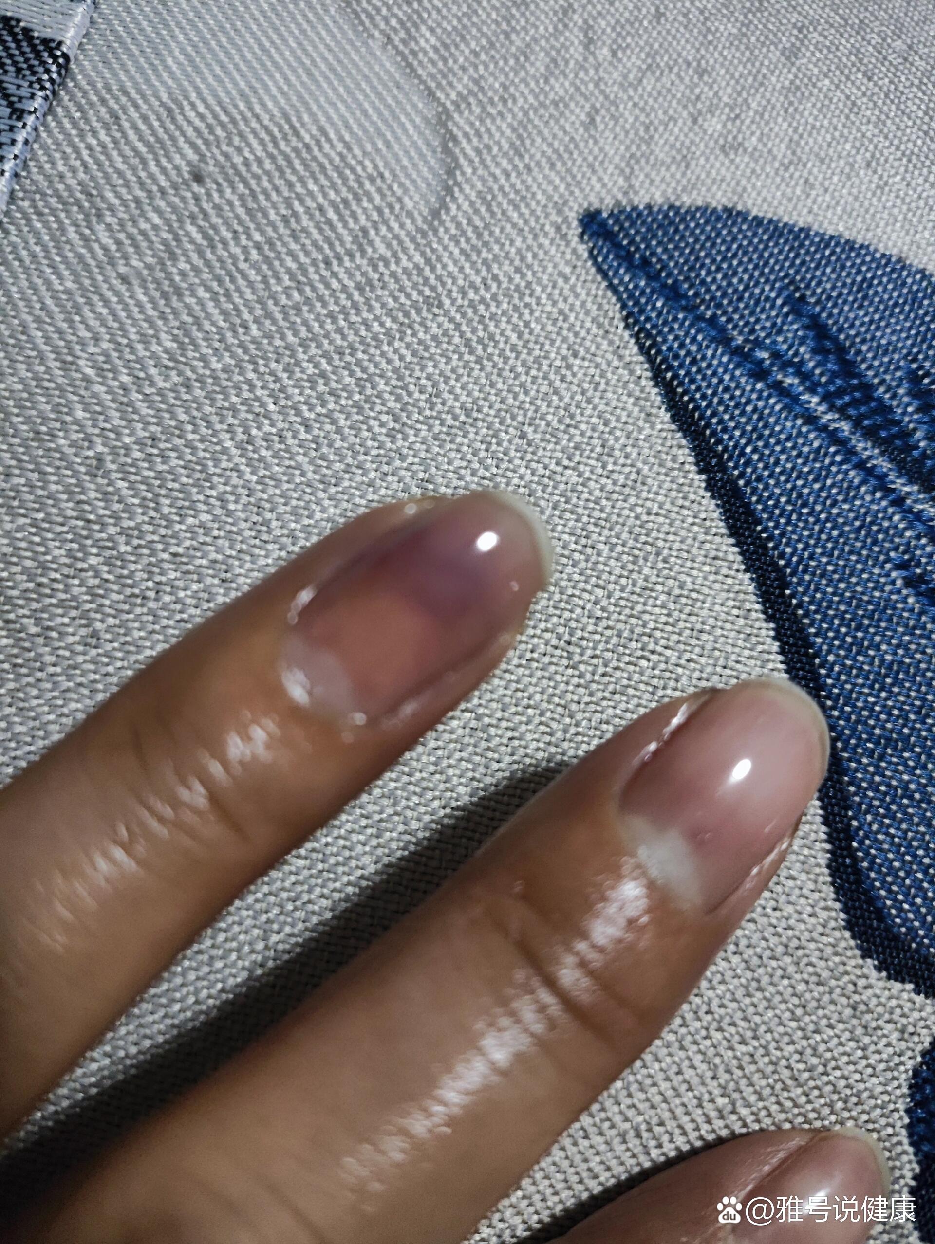 把冰块夹好了不能掉出来的方法掌握技巧，如何正确夹住冰块并防止其掉落