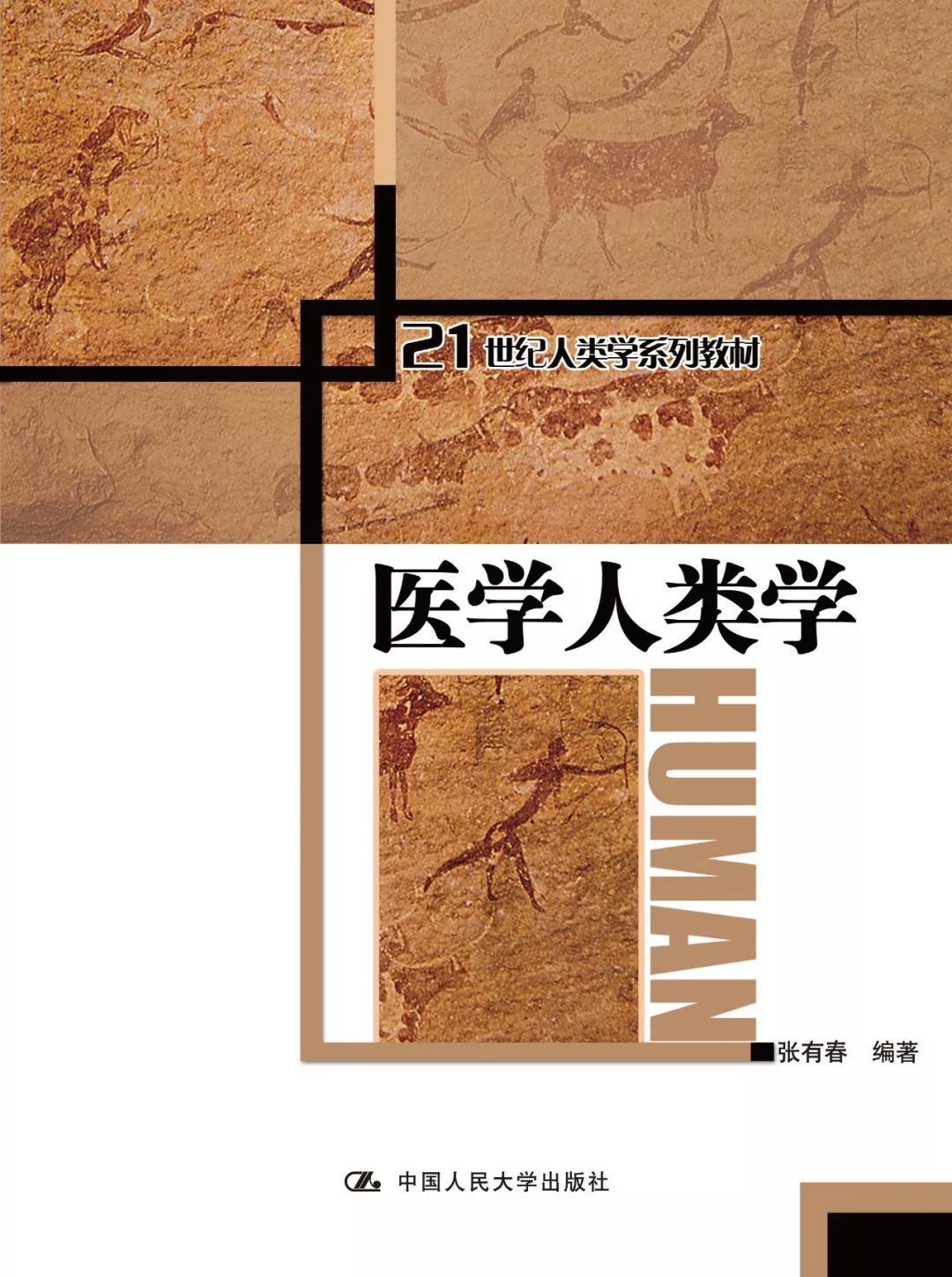导尿术的必要性及WRITE AS在医疗实践中的应用