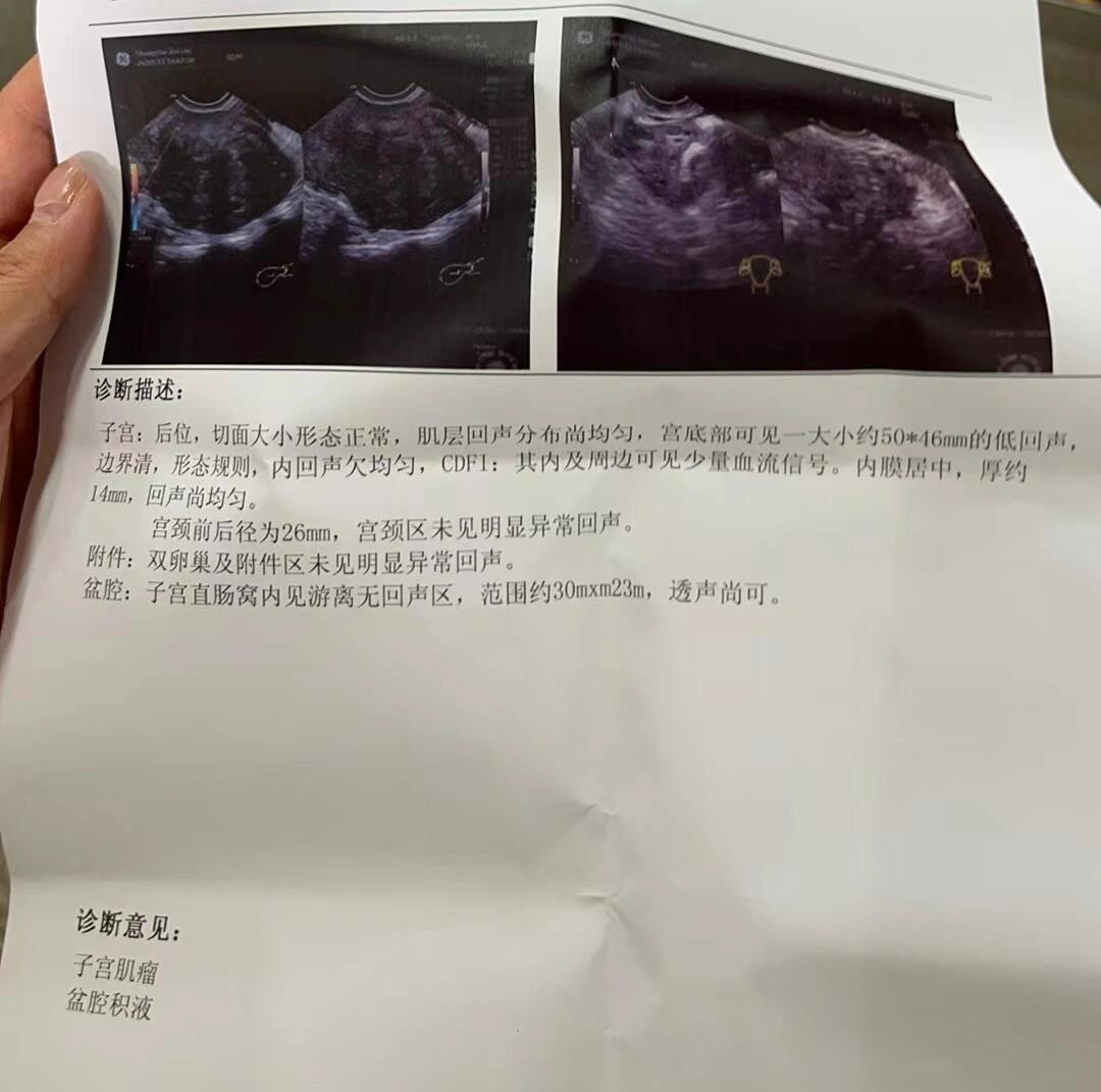 子宫肌瘤腹腔镜术后发烧怎么办探索Linode云服务与娇小iPhone 6s的完美结合
