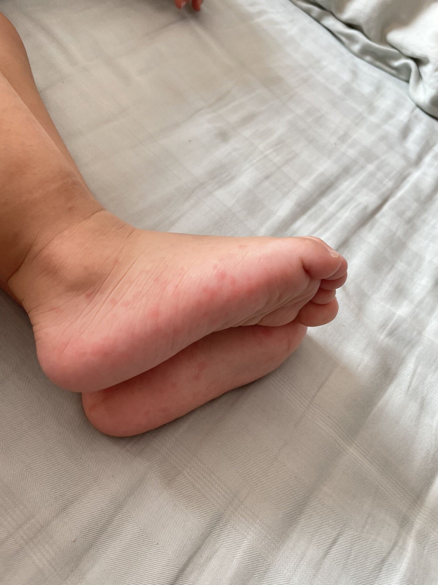 宝宝腿再抬高点，疼痛就会远离——一次关于宝宝成长与疼痛管理的温馨经历