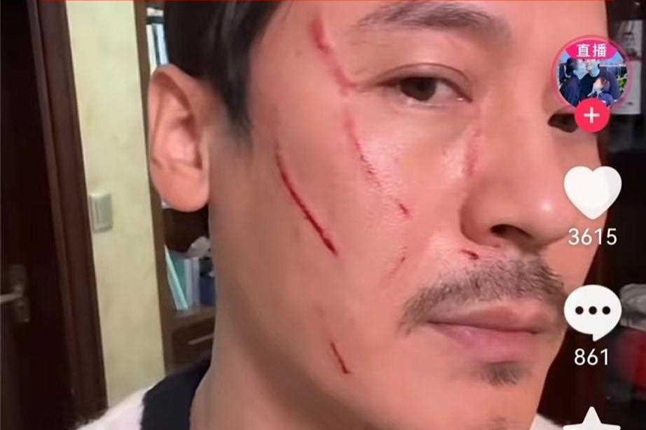 圈内门事件圈内事件深度解析-第2张图片