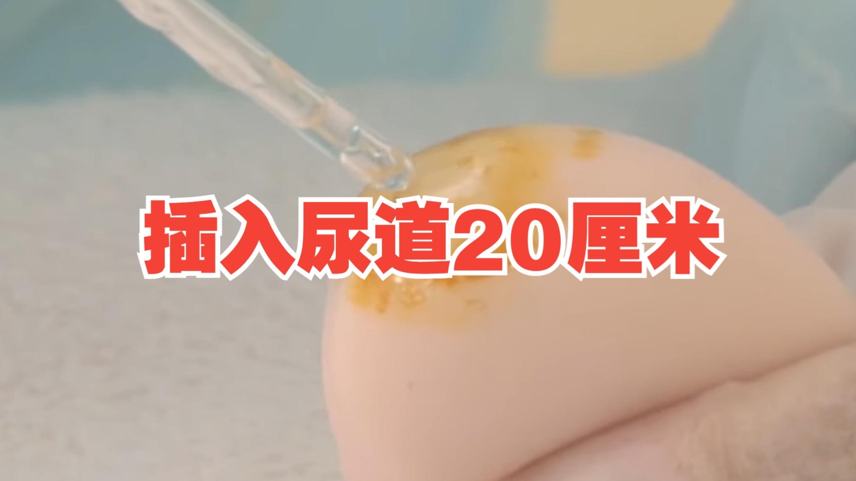WRITE AS 导尿导尿的注意事项与WRITE AS在医疗护理中的应用-第3张图片