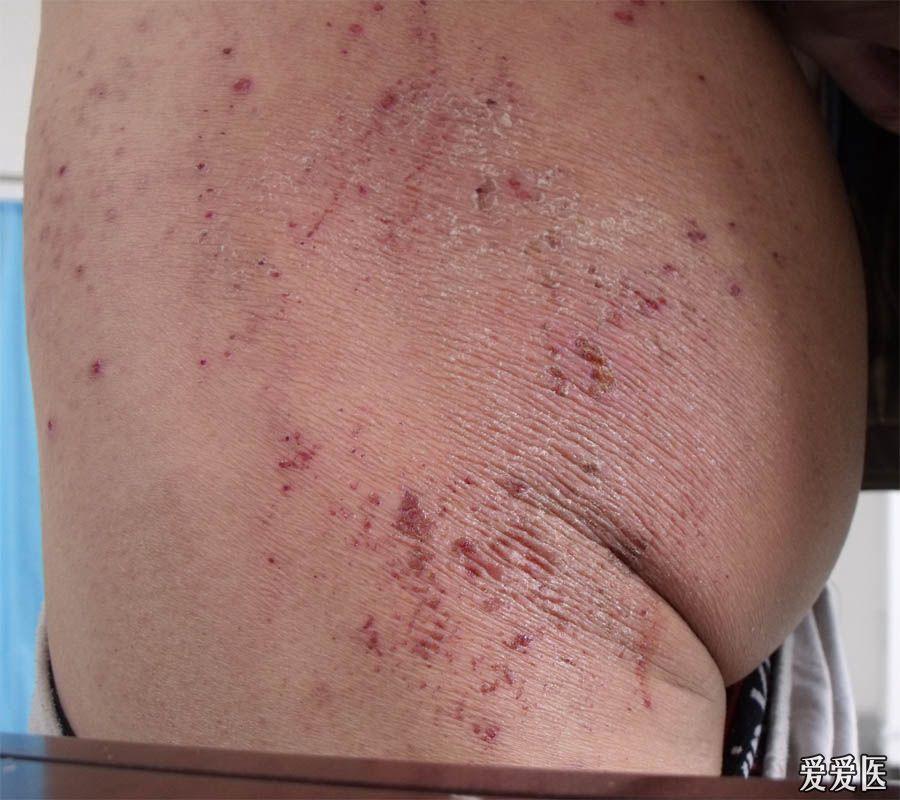 关于网络传播打女生光屁屁图片的反思-第3张图片