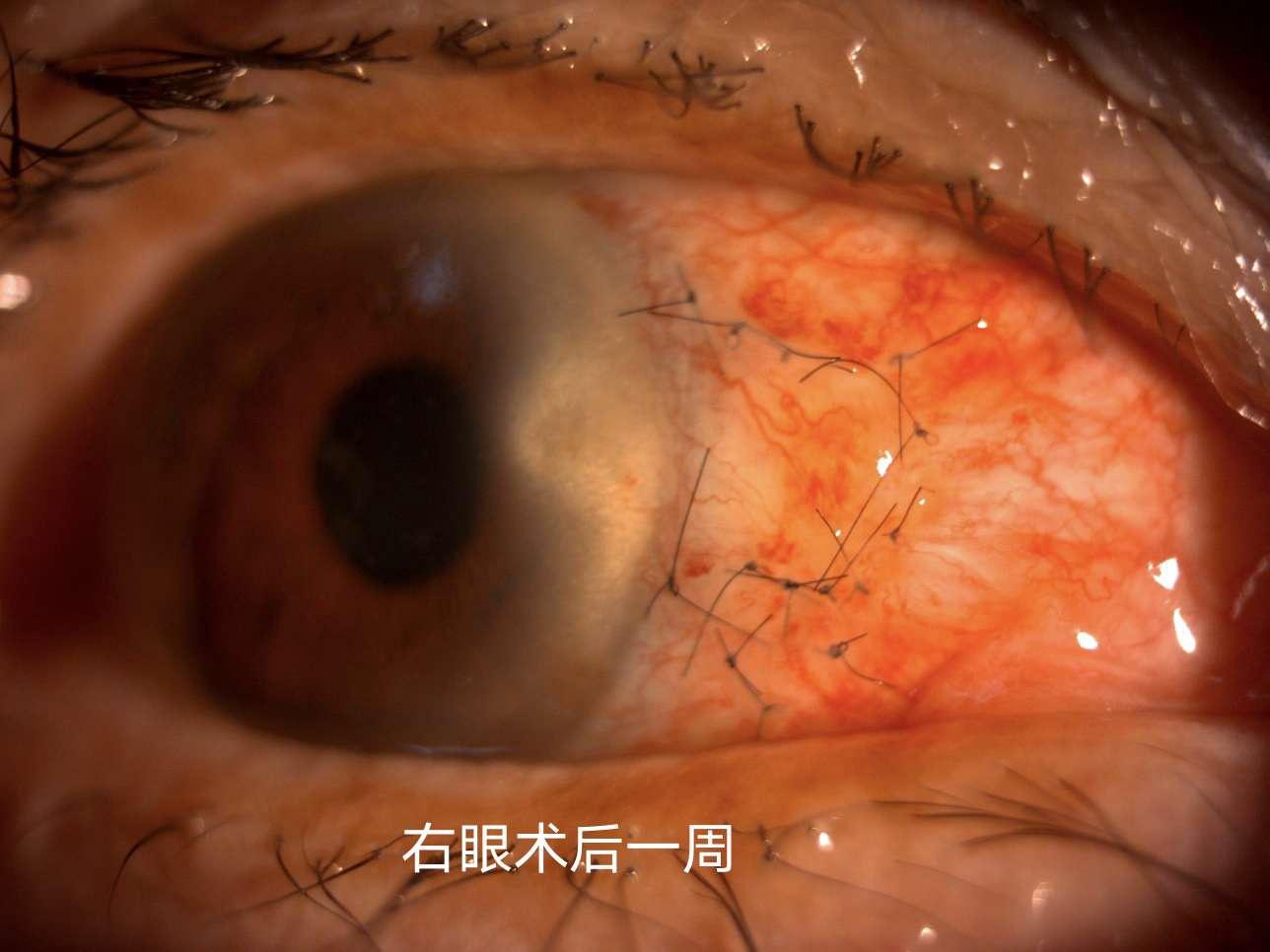 超级胬肉系统全文免费污污肉文，情色之下的情感探索-第1张图片
