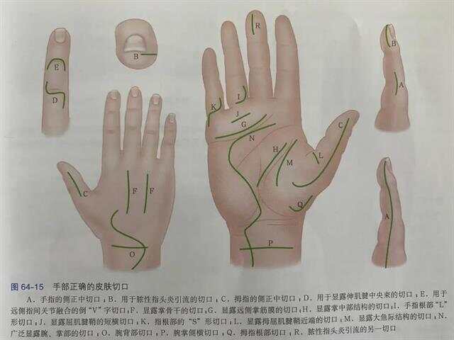 如何通过手部感知确定C点位置-第3张图片