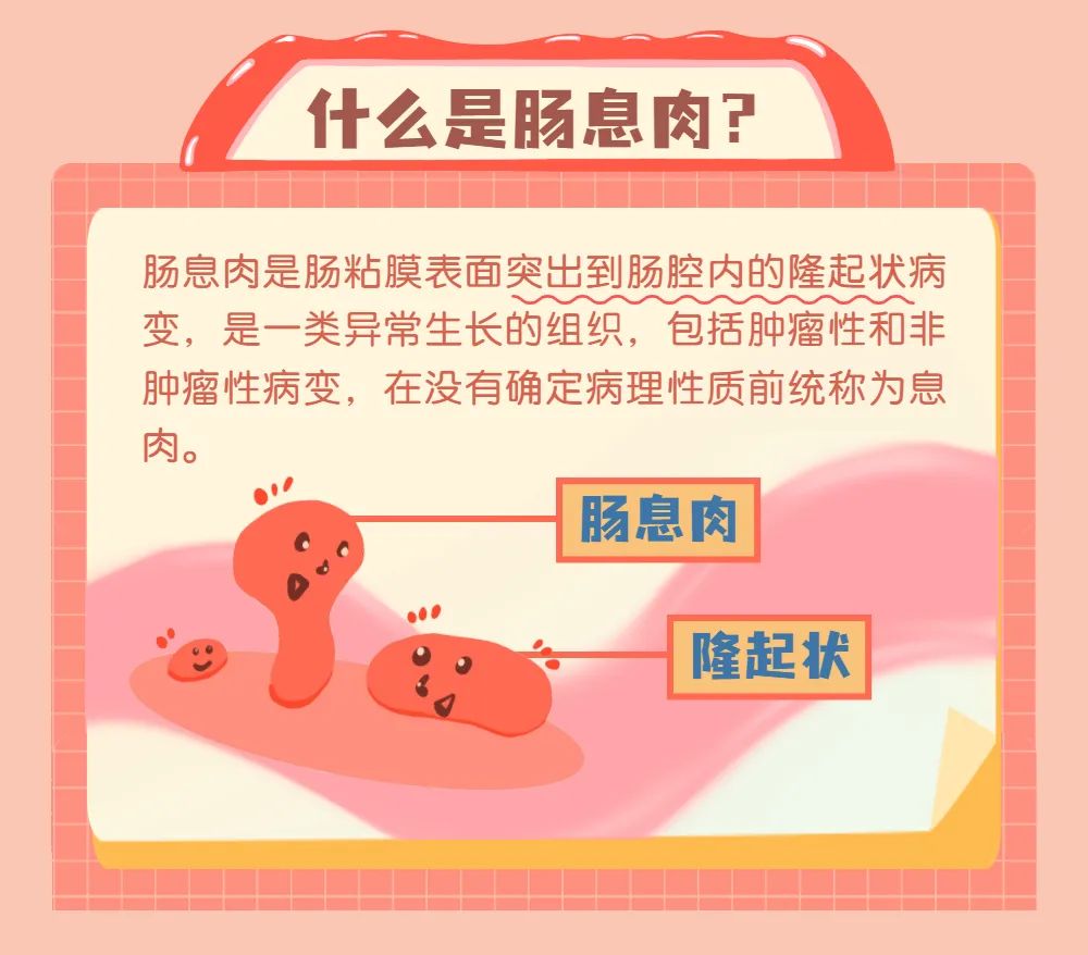 欧美肠交欧美肠交，一种独特的健康生活方式-第2张图片
