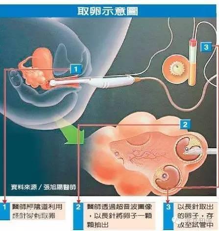 中国人z00国产人与禽类关系探讨，伦理、生态与健康