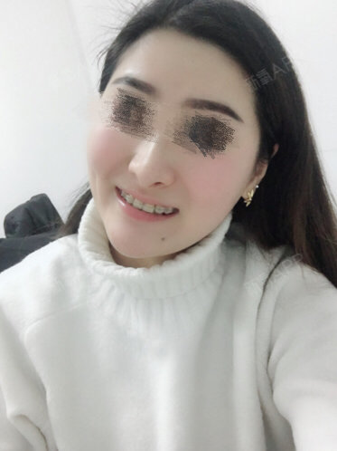 红肿疼痛小缝不能合拢红肿疼痛的小缝无法合拢的困扰-第2张图片