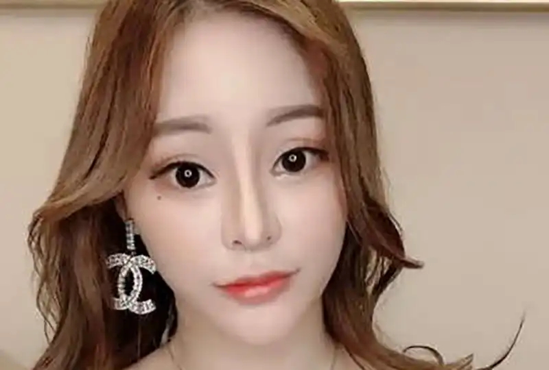 Gogogo，免费观看高清视频的便捷之选