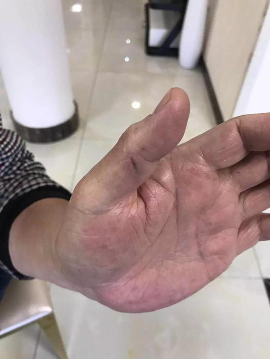 大爷的手为何伸得如此长？-第1张图片
