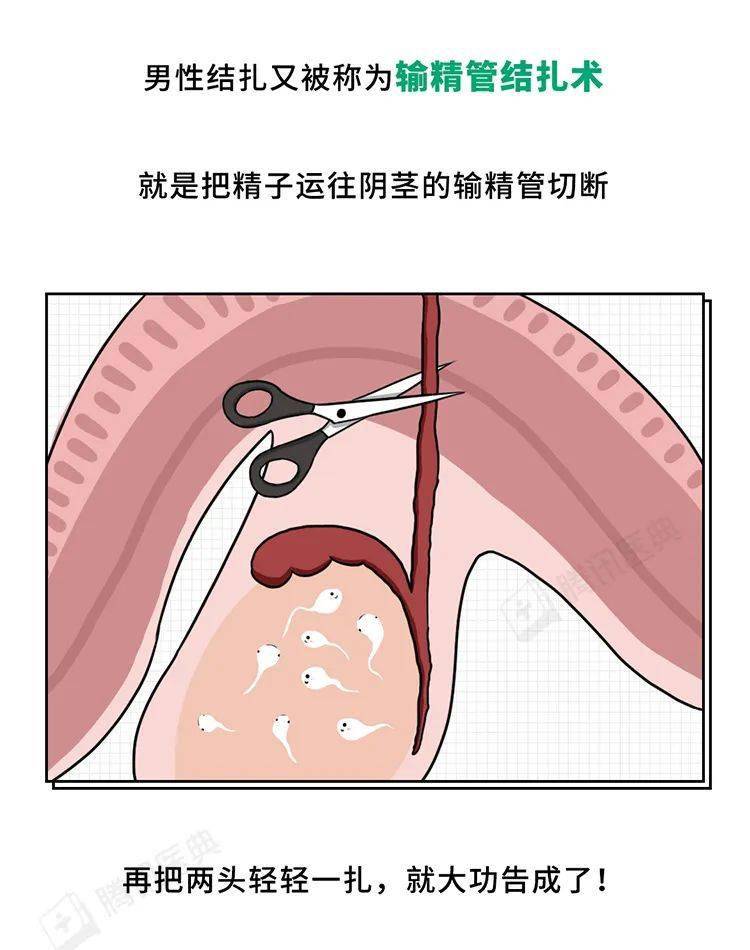 妈妈结扎了可以干吗香港警匪片妈妈结扎后的生活新篇章-第2张图片